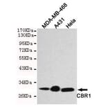 Anti-CBR1 Antibody from Bioworld Technology (MB0121) - Antibodies.com