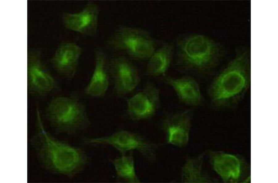 Anti-CBR1 Antibody from Bioworld Technology (MB0121) - Antibodies.com