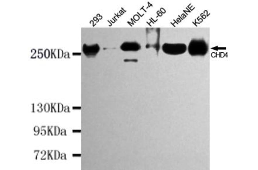 Anti-CHD4 Antibody from Bioworld Technology (MB0126) - Antibodies.com