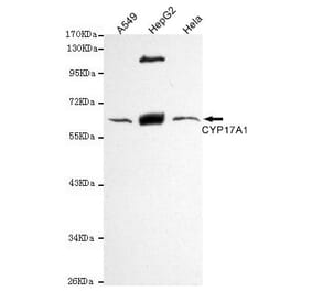 Anti-CYP17A1 Antibody from Bioworld Technology (MB0132) - Antibodies.com