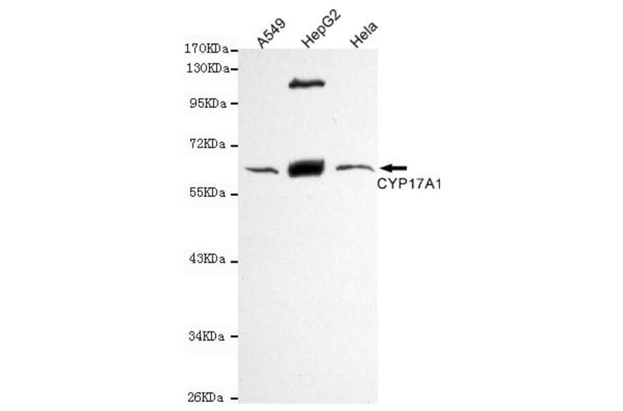 Anti-CYP17A1 Antibody from Bioworld Technology (MB0132) - Antibodies.com