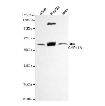 Anti-CYP17A1 Antibody from Bioworld Technology (MB0132) - Antibodies.com