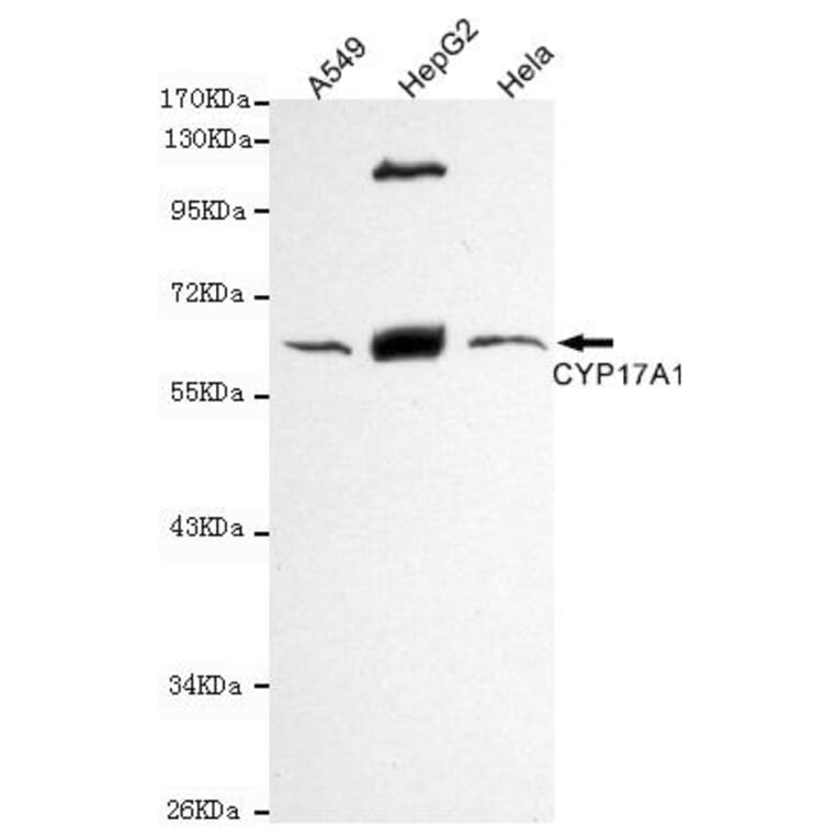 Anti-CYP17A1 Antibody from Bioworld Technology (MB0132) - Antibodies.com