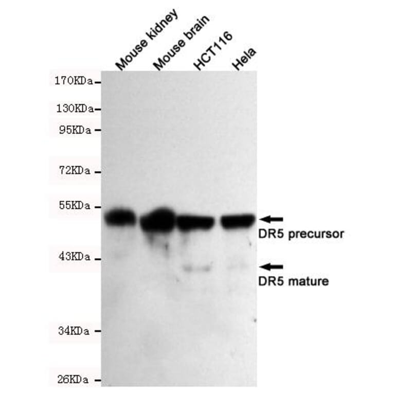 Anti-TNFRSF10B / DR5 Antibody from Bioworld Technology (MB0135) - Antibodies.com