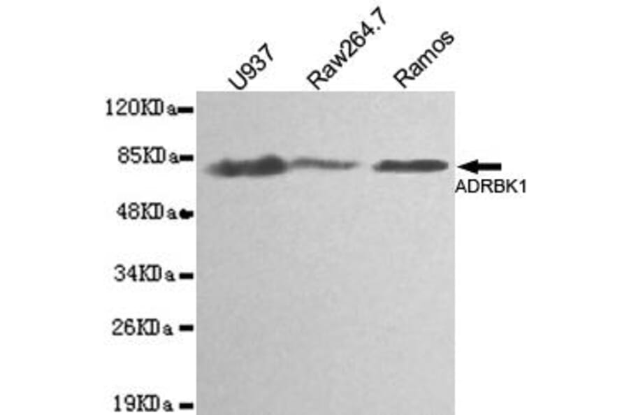 Anti-GRK 2 / ADRBK1 Antibody from Bioworld Technology (MB0139) - Antibodies.com