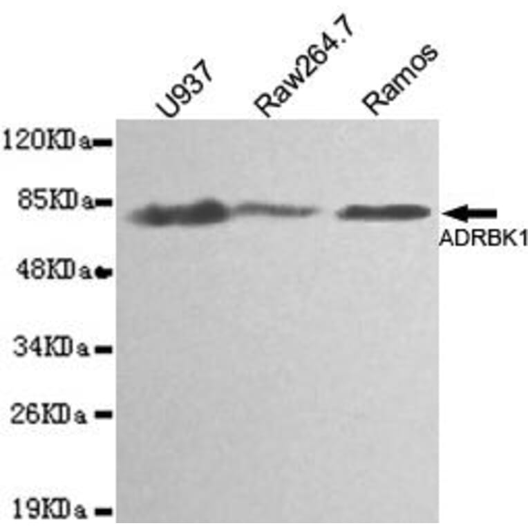 Anti-GRK 2 / ADRBK1 Antibody from Bioworld Technology (MB0139) - Antibodies.com
