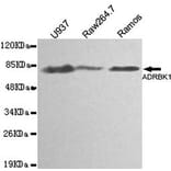 Anti-GRK 2 / ADRBK1 Antibody from Bioworld Technology (MB0139) - Antibodies.com