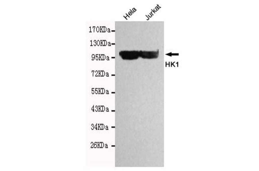 Anti-HXK I / HK1 Antibody from Bioworld Technology (MB0140) - Antibodies.com