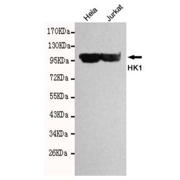 Anti-HXK I / HK1 Antibody from Bioworld Technology (MB0140) - Antibodies.com