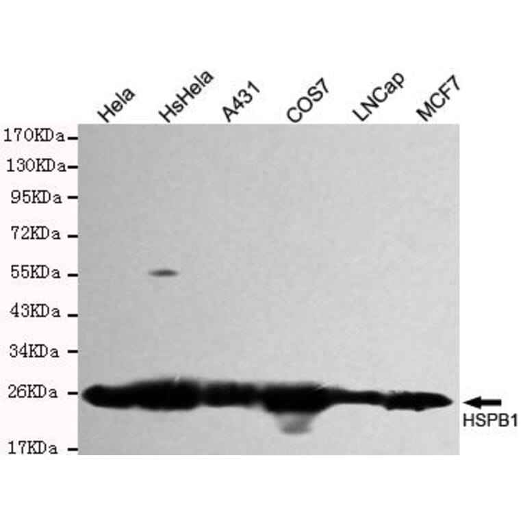 Anti-HSP27 Antibody from Bioworld Technology (MB0141) - Antibodies.com