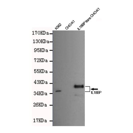 Anti-IL18BP Antibody from Bioworld Technology (MB0143) - Antibodies.com
