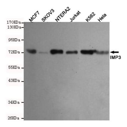 Anti-IMP3 Antibody from Bioworld Technology (MB0144) - Antibodies.com