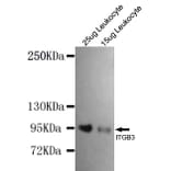 Anti-Integrin β3 (N-terminus) Antibody from Bioworld Technology (MB0145) - Antibodies.com