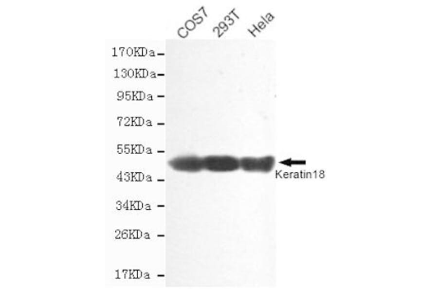 Anti-Cytokeratin 18 Antibody from Bioworld Technology (MB0146) - Antibodies.com