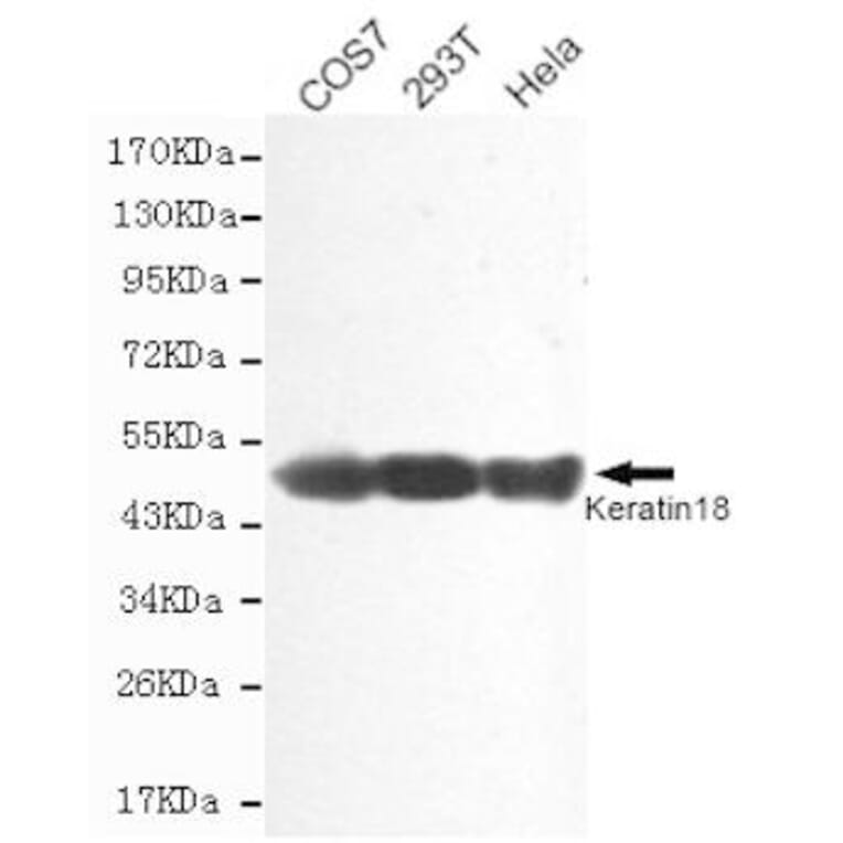 Anti-Cytokeratin 18 Antibody from Bioworld Technology (MB0146) - Antibodies.com