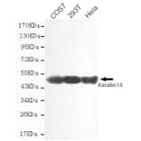Anti-Cytokeratin 18 Antibody from Bioworld Technology (MB0146) - Antibodies.com