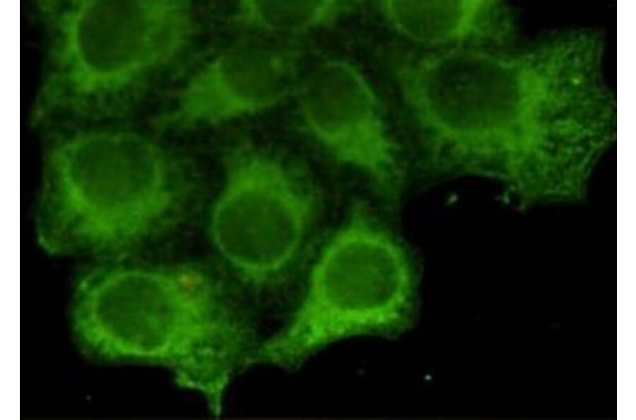 Anti-Cytokeratin 18 Antibody from Bioworld Technology (MB0146) - Antibodies.com