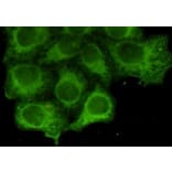 Anti-Cytokeratin 18 Antibody from Bioworld Technology (MB0146) - Antibodies.com