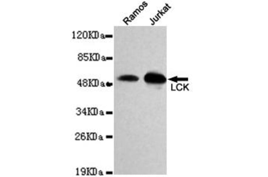 Anti-Lck Antibody from Bioworld Technology (MB0148) - Antibodies.com