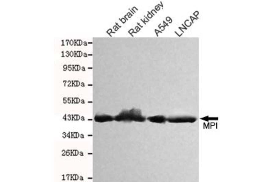Anti-MPI Antibody from Bioworld Technology (MB0150) - Antibodies.com