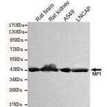 Anti-MPI Antibody from Bioworld Technology (MB0150) - Antibodies.com