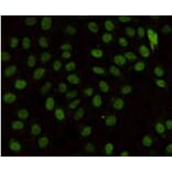 Anti-MLH1 Antibody from Bioworld Technology (MB0151) - Antibodies.com