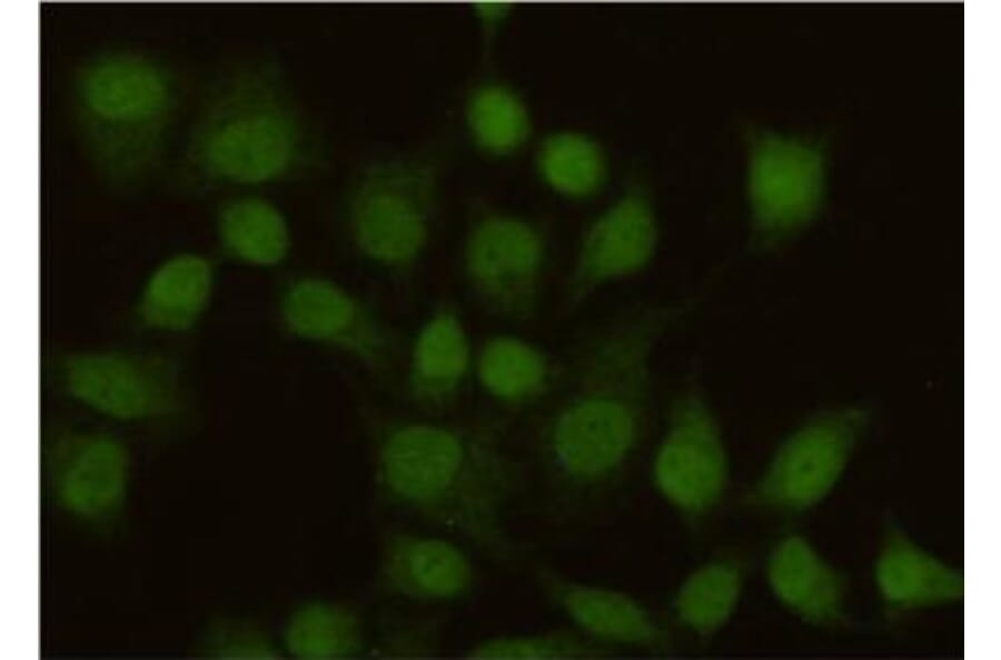 Anti-MSH2 Antibody from Bioworld Technology (MB0152) - Antibodies.com