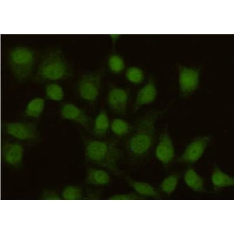 Anti-MSH2 Antibody from Bioworld Technology (MB0152) - Antibodies.com