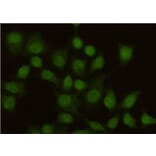 Anti-MSH2 Antibody from Bioworld Technology (MB0152) - Antibodies.com