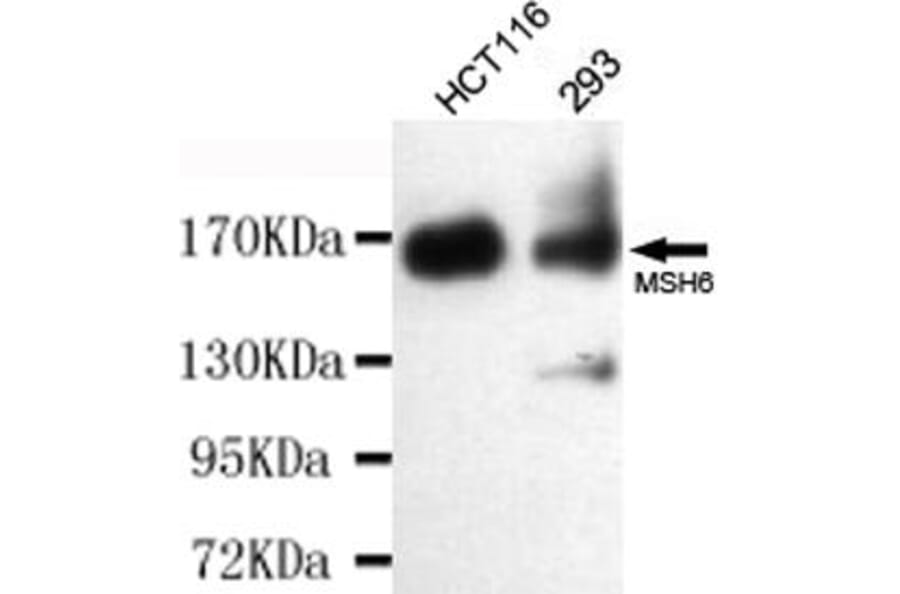 Anti-MSH6 Antibody from Bioworld Technology (MB0153) - Antibodies.com