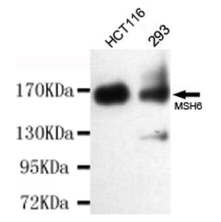 Anti-MSH6 Antibody from Bioworld Technology (MB0153) - Antibodies.com
