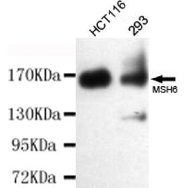 Anti-MSH6 Antibody from Bioworld Technology (MB0153) - Antibodies.com