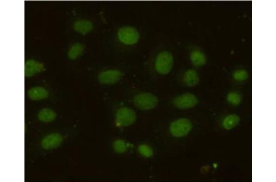 Anti-MSH6 Antibody from Bioworld Technology (MB0153) - Antibodies.com