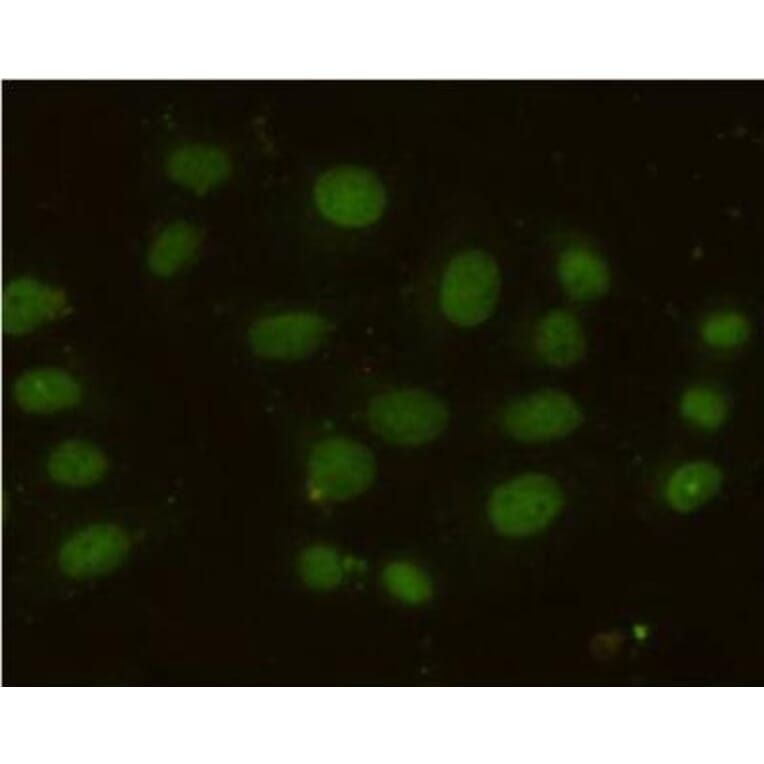 Anti-MSH6 Antibody from Bioworld Technology (MB0153) - Antibodies.com