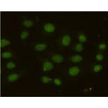 Anti-MSH6 Antibody from Bioworld Technology (MB0153) - Antibodies.com