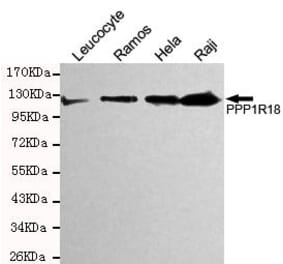 Anti-Phostensin Antibody from Bioworld Technology (MB0157) - Antibodies.com