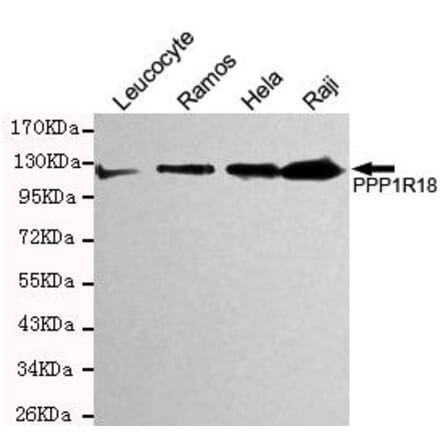 Anti-Phostensin Antibody from Bioworld Technology (MB0157) - Antibodies.com