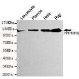 Anti-Phostensin Antibody from Bioworld Technology (MB0157) - Antibodies.com