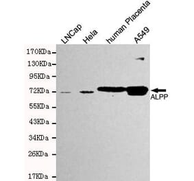 Anti-ALPP Antibody from Bioworld Technology (MB0158) - Antibodies.com