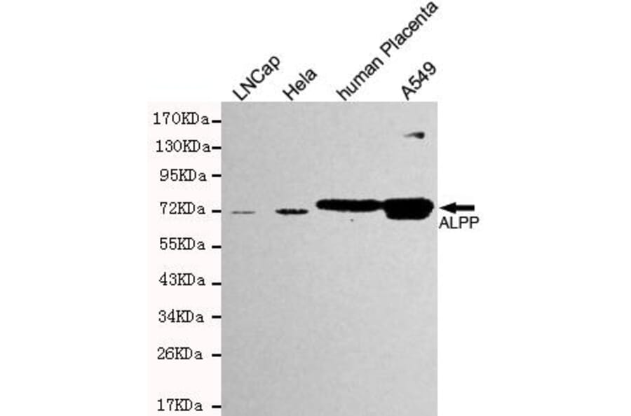 Anti-ALPP Antibody from Bioworld Technology (MB0158) - Antibodies.com
