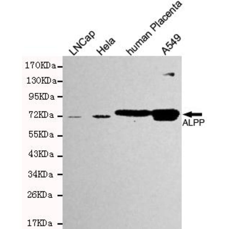 Anti-ALPP Antibody from Bioworld Technology (MB0158) - Antibodies.com