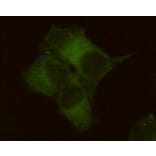 Anti-ALPP Antibody from Bioworld Technology (MB0158) - Antibodies.com