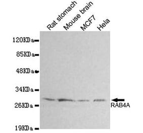 Anti-RAB4A Antibody from Bioworld Technology (MB0161) - Antibodies.com