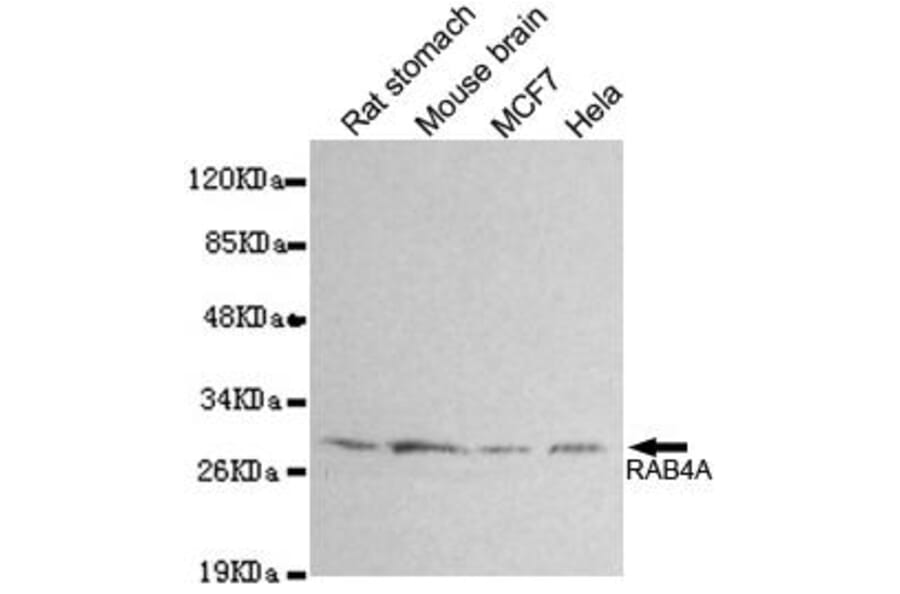 Anti-RAB4A Antibody from Bioworld Technology (MB0161) - Antibodies.com
