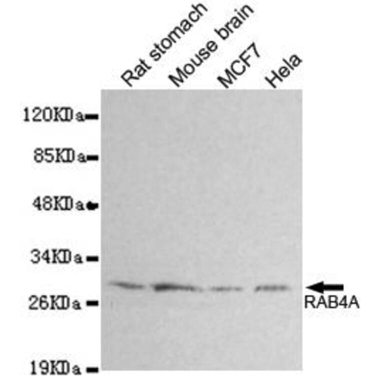 Anti-RAB4A Antibody from Bioworld Technology (MB0161) - Antibodies.com