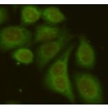 Anti-RAB4A Antibody from Bioworld Technology (MB0161) - Antibodies.com