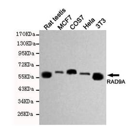 Anti-RAD9A Antibody from Bioworld Technology (MB0162) - Antibodies.com