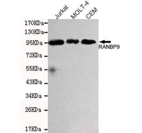 Anti-RanBP9 Antibody from Bioworld Technology (MB0163) - Antibodies.com