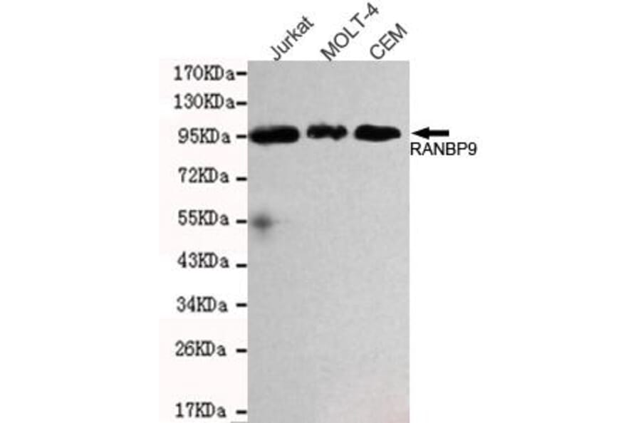 Anti-RanBP9 Antibody from Bioworld Technology (MB0163) - Antibodies.com