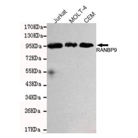 Anti-RanBP9 Antibody from Bioworld Technology (MB0163) - Antibodies.com